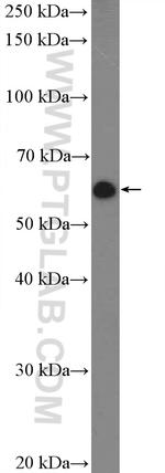 CREB3L2 Antibody in Western Blot (WB)