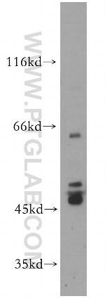 PTPN5 Antibody in Western Blot (WB)