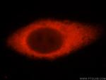 USP14 Polyclonal Antibody