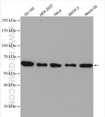 USP14 Antibody in Western Blot (WB)