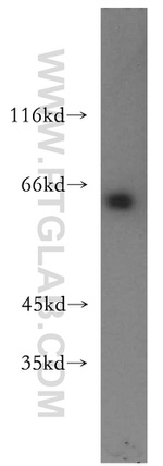 USP14 Antibody in Western Blot (WB)