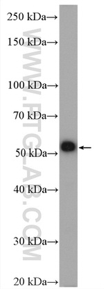 USP14 Antibody in Western Blot (WB)