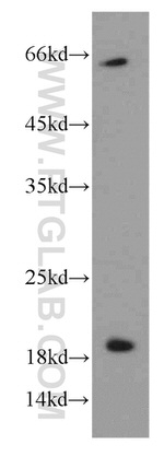 ENSA Antibody in Western Blot (WB)