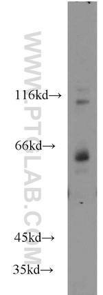 TCF7L1 Antibody in Western Blot (WB)