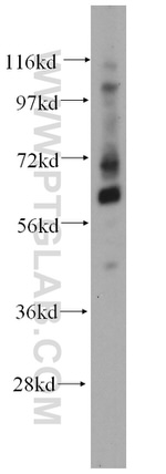 TCF7L1 Antibody in Western Blot (WB)