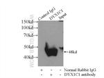 DYX1C1 Antibody in Immunoprecipitation (IP)