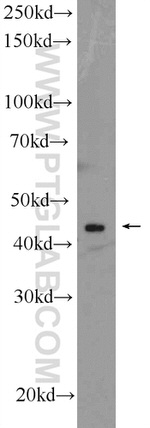 DYX1C1 Antibody in Western Blot (WB)