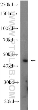DYX1C1 Antibody in Western Blot (WB)
