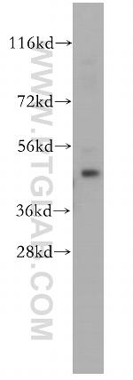 DYX1C1 Antibody in Western Blot (WB)