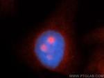 MYBBP1A Antibody in Immunocytochemistry (ICC/IF)