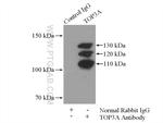 TOP3A Antibody in Immunoprecipitation (IP)