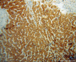 ACADVL Antibody in Immunohistochemistry (Paraffin) (IHC (P))