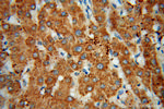 ACADVL Antibody in Immunohistochemistry (Paraffin) (IHC (P))