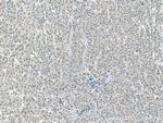 ACADVL Antibody in Immunohistochemistry (Paraffin) (IHC (P))