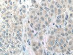 ACADVL Antibody in Immunohistochemistry (Paraffin) (IHC (P))