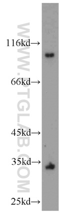 ACADVL Antibody in Western Blot (WB)