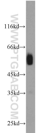 ACADVL Antibody in Western Blot (WB)