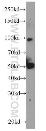 ACADVL Antibody in Western Blot (WB)