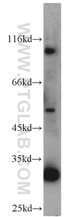 ACADVL Antibody in Western Blot (WB)