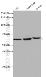 ACADVL Antibody in Western Blot (WB)