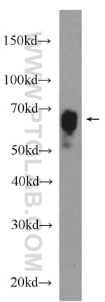 TOM70 Antibody in Western Blot (WB)