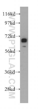 ZNF410 Antibody in Western Blot (WB)
