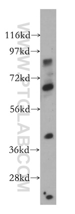 ZNF410 Antibody in Western Blot (WB)