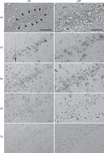 Galectin 3 Antibody in Immunohistochemistry (IHC)