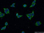 LAMR1/RPSA Antibody in Immunocytochemistry (ICC/IF)