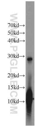 Hemoglobin alpha Antibody in Western Blot (WB)