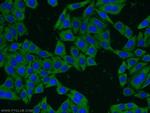 TCP10 Antibody in Immunocytochemistry (ICC/IF)