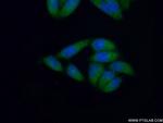MLL5 Antibody in Immunocytochemistry (ICC/IF)