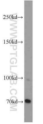 MLL5 Antibody in Western Blot (WB)