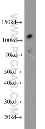 MLL5 Antibody in Western Blot (WB)