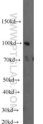 MLL5 Antibody in Western Blot (WB)