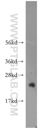 LZIC Antibody in Western Blot (WB)