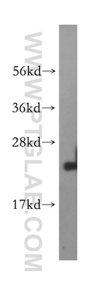 LZIC Antibody in Western Blot (WB)