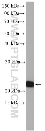 LZIC Antibody in Western Blot (WB)