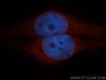 CLIC1 Antibody in Immunocytochemistry (ICC/IF)