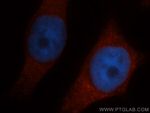 CLIC1 Antibody in Immunocytochemistry (ICC/IF)