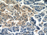 CLIC1 Antibody in Immunohistochemistry (Paraffin) (IHC (P))