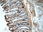 CLIC1 Antibody in Immunohistochemistry (Paraffin) (IHC (P))
