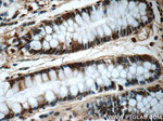CLIC1 Antibody in Immunohistochemistry (Paraffin) (IHC (P))