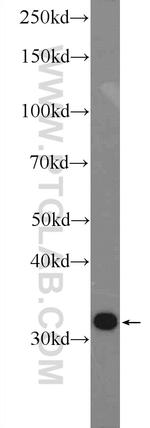 CLIC1 Antibody in Western Blot (WB)