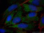 LDHC Antibody in Immunocytochemistry (ICC/IF)