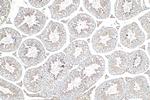 LDHC Antibody in Immunohistochemistry (Paraffin) (IHC (P))