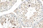 LDHC Antibody in Immunohistochemistry (Paraffin) (IHC (P))