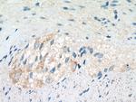 MSRA Antibody in Immunohistochemistry (Paraffin) (IHC (P))