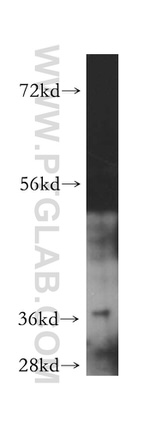 ARFIP2 Antibody in Western Blot (WB)