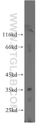 ARFIP2 Antibody in Western Blot (WB)